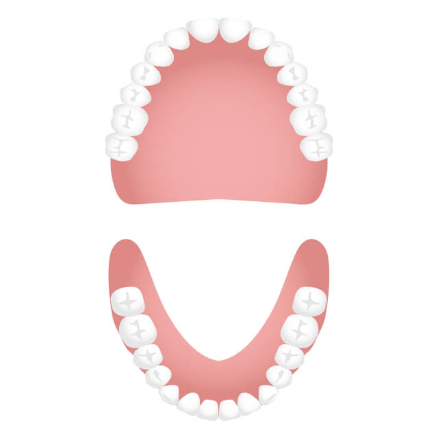 総入れ歯（総義歯）