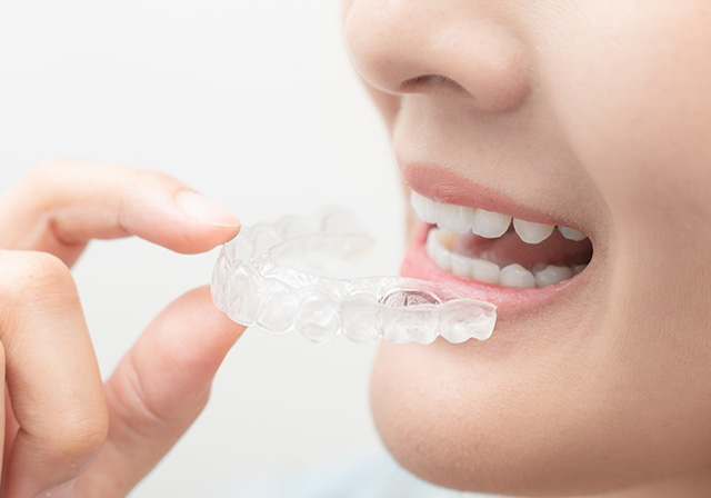 マウスピース矯正